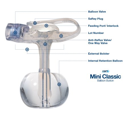Applied Medical Technologies Balloon Button Gastrostomy Feeding Device AMT MINI Classic 14 Fr. 5 cm Tube Silicone Sterile - Each - 5-1450-EA