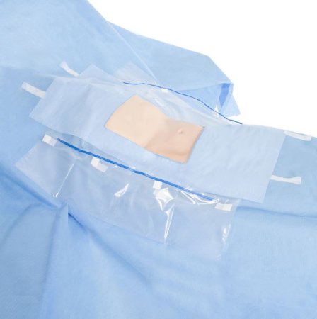 O&M Halyard Inc Abdominal Drape Halyard Laparoscopic / Cholecystectomy Drape 102 W X 120 W X 76 L Inch NonSterile - Case of 18 - 79233-CS