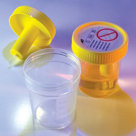 Globe Scientific Urine Specimen Container with Integrated Transfer Device TransferTop™ 120 mL (4 oz.) Screw Cap Sterile - Case of 300 - 3856L-CS