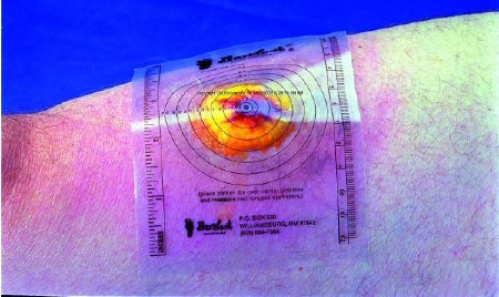 Trademark Medical Measuring Guide 3-3/4 X 5-1/2 Inch Plastic - Box of 250 - B250-BX