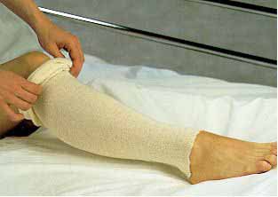 Alba Healthcare Stockinette Tubular Albahealth® 3 Inch X 25 Yard Cotton NonSterile - Case of 12 - 81320-CS