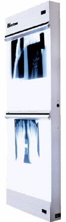 Wolf X-Ray X-Ray Illuminator Trimline Basic 1 Bank 1 Tier 2 Lamp 15 W Wall Mount 3-1/4 X 14 X 22 Inch White One, 14 X 17 Inch Film - Each - 29501-EA