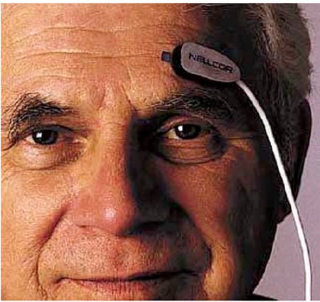 Medtronic MITG SpO2 Sensor Oxisensor™ Forehead Adult Reusable - Case of 6 - RS10-CS