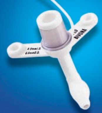 Smiths Medical ASD, Inc. Cuffed Tracheostomy Tube Bivona® TTS™ Size 2.5 Pediatric - Each - 67P025-EA