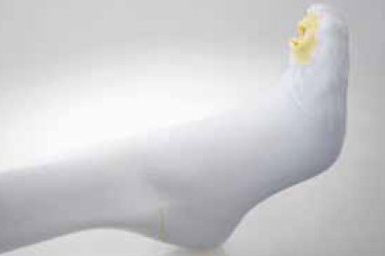 Alba Healthcare Anti-embolism Stocking UltraCARE® Knee High 2X-Large / Regular Open Toe - Case of 12 - 853-05-CS