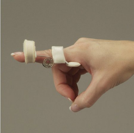 DeRoyal Extension Assist Finger Spring DeRoyal® Medium Left or Right Hand White - Each - 502B-EA