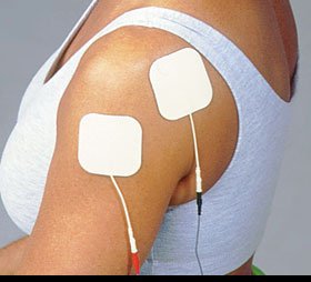 Alimed Pals® Neurostimulation Electrode - Box of 10 - 2970001454-BX
