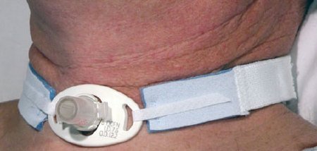 Vyaire Medical Tracheostomy Tube Holder AirLife® Neonatal / Pediatric - Case of 100 - RES242A-CS