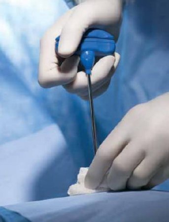 BD Biopsy Tray Safe-T™ Plus Bone Marrow Without Needle - Case of 10 - BK1000SP-CS