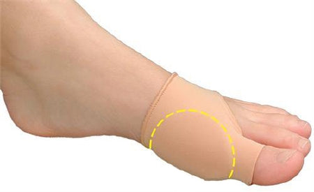 Pedifix Bunion Sleeve Visco-GEL® Bunion Care™ Small / Medium Pull-On Foot - Each - 1309-EA