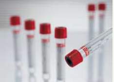 Greiner Bio-One VACUETTE® Z Serum Clot Activator Venous Blood Collection Tube Clot Activator Additive 9 mL Pull Cap Polyethylene Terephthalate (PET) Tube - Each - 455092-EA