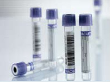 Greiner Bio-One VACUETTE® Venous Blood Collection Tube Serum Tube K2 EDTA Additive 13 X 75 mm 3 mL Lavender / Black Ring Pull Cap Polyethylene Terephthalate (PET) Tube - Case of 1200 - 454246-CS
