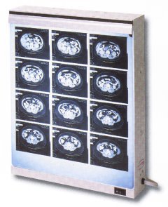 Wolf X-Ray X-Ray Illuminator Econoline 1 Bank 1 Tier 2 Lamp 15 W Wall Mount 18-1/4 W X 14 H X 3-1/2 D Inch One, 17 L X 14 W Inch Film - Each - 29601-EA