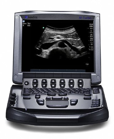 Soma Technology Refurbished Ultrasound System Sonosite M - Turbo With Probe, Up to 165 dB Dynamic Range, 256 Shades Grey Scale, Audio Output, Integrated Speakers, Lithium-Ion Battery, MPEG-4 (H.264), JPEG, BMP, HTML USB Storage - Each - SON-002-EA