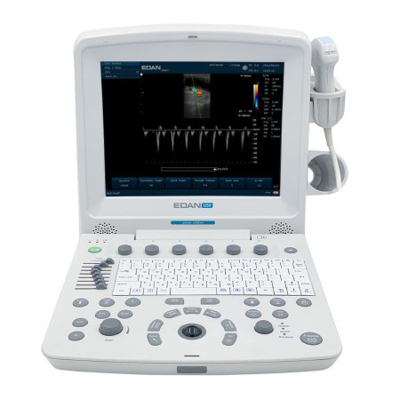 EdanUSA & MDPro Ultrasound System U50 Series 12.1 Inch Display Size, 2 USB Ports, 504 MB Built-In Image Storage, 256 Frames CINE Loop Memory - Each - U50 PRIME-EA