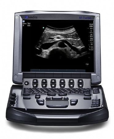 Soma Technology Refurbished Ultrasound System Sonosite M - Turbo With Cart, Up to 165 dB Dynamic Range, 256 Shades Grey Scale, Audio Output, Integrated Speakers, Lithium-Ion Battery, MPEG-4 (H.264), JPEG, BMP, HTML USB Storage - Each - SONO-MAX-BLNCE-EA