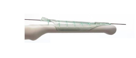 Aspen Surgical Products (Protek) Endocavity Needle Guide Aquamarine, Sterile, Disposable - Box of 24 - 1-535-9000-BX
