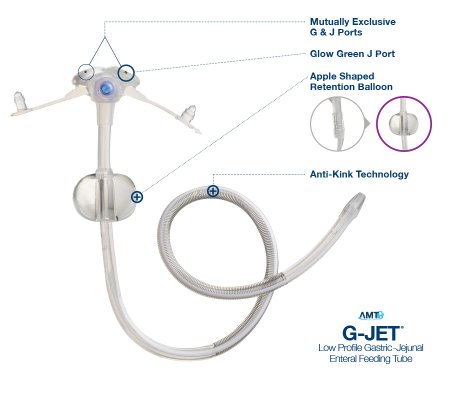 Applied Medical Technologies Low Profile Button Gastrostomy / Jejunal Tube G-JET® 14 Fr. 2 X 30 cm Tube - Each - GJ-1420-30-EA