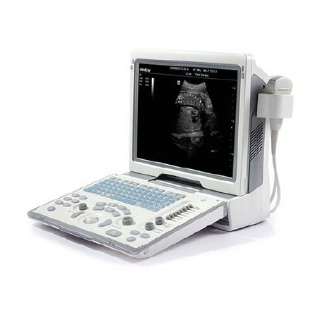 Mindray USA Ultrasound System DP-50 - Each - 1151E-PA00002-EA