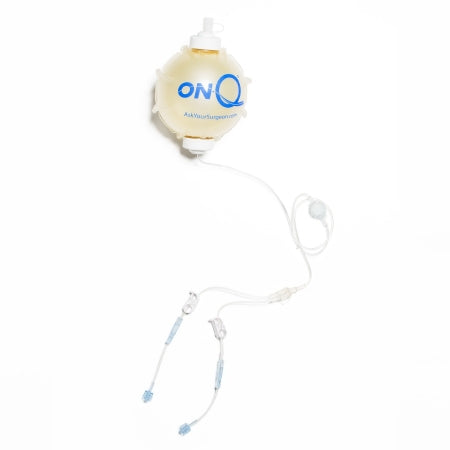 Avanos Medical Sales LLC Elastomeric Pump ON-Q* Gravity Disposable 270 mL Capacity 270 mL Volume 4 mL / Hr. Flow Rate - Case of 5 - PM025-A-CS