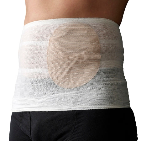 Tytex Ostomy Belt X-Large - Case of 24 - 500052-07.03.T49-CS