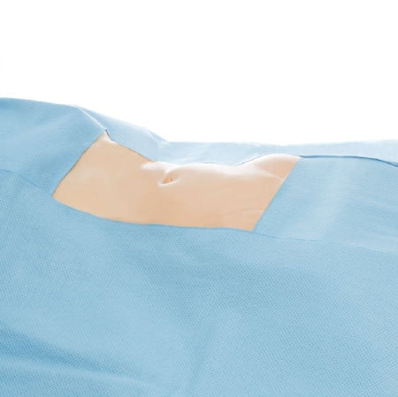 O&M Halyard Inc Surgical Drape Top Drape 50 W X 108 L Inch NonSterile - Case of 32 - 79571-CS