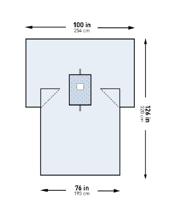 McKesson Surgical Drape McKesson Breast Drape 100 W X 76 W X 126 L Inch Sterile - Pack of 1 - 183-I80-05214G-S-PK