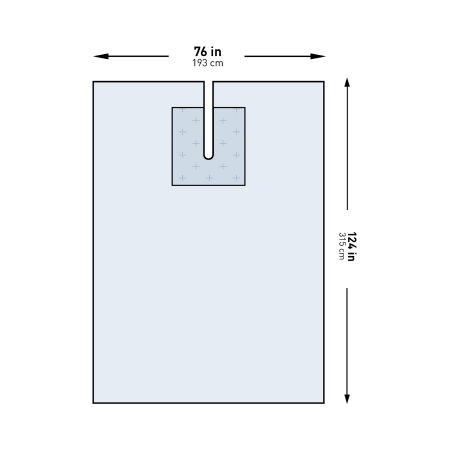 McKesson EENT Drape McKesson EENT Split Drape 76 W X 124 L Inch Sterile - Pack of 1 - 183-I80-09143G-S-PK