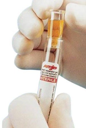 Cardinal Sample Cup Monoject™ Ezee-Nest™ For 13 mm Collection Tubes - Pack of 1000 - 1270013000-PK