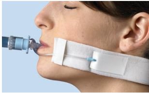 Cooper Surgical Endotracheal Tube Holder - Box of 25 - 42-1820-BX
