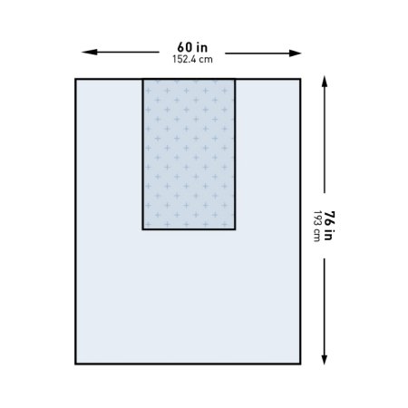 McKesson General Purpose Drape McKesson Three-Quarter Drape 60 W X 76 L Inch Sterile - Case of 20 - 16-I80-12110G-S-CS
