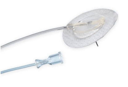 Intra Pump Infusion Systems Subcutaneous Infusion Set Neria™ 29 Gauge 6 mm 42 Inch Tubing - Box of 10 - PP1102936N-BX