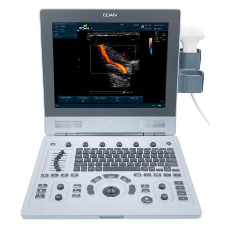 EdanUSA & MDPro Ultrasound System - Each - U60_MAINUNIT-EA