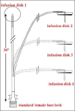 Norfolk Medical Products Sub-Q Infusion Set ClearView™ MS Without Needle 20 Inch Tubing Without Port - Box of 6 - SCIG60001-BX
