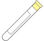 BD BD Vacutainer® Venous Blood Collection Tube Whole Blood Tube ACD Solution A Additive 16 X 100 mm 8.5 mL Yellow Conventional Closure Glass Tube - Case of 1000 - 364606-CS