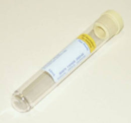 BD BD Vacutainer® Urinalysis Tube Round Bottom Plain 16 X 100 mm 10 mL Yellow Conventional Closure Plastic Tube - Case of 1000 - 364979-CS