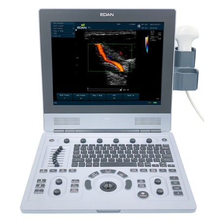 EdanUSA & MDPro Ultrasound System EDAN U60 - Each - U60-D-EA