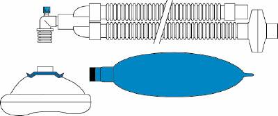 Smiths Medical ASD, Inc. Portex® Anesthesia Breathing Circuit Corrugated Tube 36 Inch Tube Dual Limb Pediatric 1 Liter Bag Single Patient Use - Case of 20 - 670804-CS