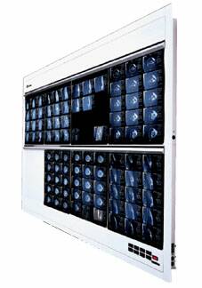 Wolf X-Ray X-Ray Illuminator Trimline Plus 1 Bank 1 Tier 4 Lamp 15 W Wall Mount 3-1/4 X 14 X 22 Inch White One, 14 X 17 Inch Film - Each - 29401-EA