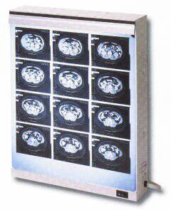 Wolf X-Ray X-Ray Illuminator Econoline 2 Bank 1 Tier 2 Lamp 15 W Wall Mount 3-1/2 X 18-1/4 X 28 Inch White Two, 14 X 17 Inch Film - Each - 29602-EA