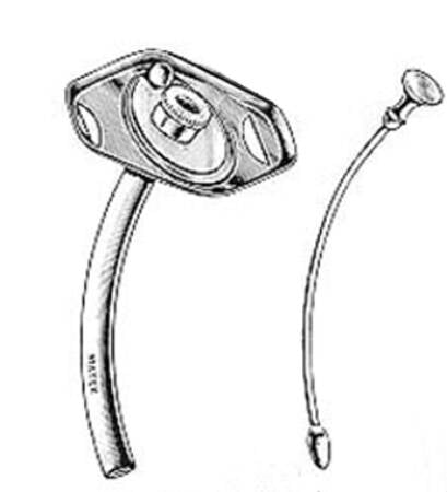 Integra Lifesciences Uncuffed Tracheostomy Tube Rotating Lock IC Size 6.0 Adult - Each - 23-1152SS-EA