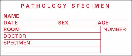 Precision Dynamics Pre-Printed Label Timemed Laboratory Use White Pathology Specimen, Name, Date, Sex, Age, Room, Doctor, Speciment, Number Red Lab / Specimen 1-1/2 X 3-1/2 Inch - Roll of 1 - SP-4-RL