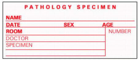 Precision Dynamics Pre-Printed Label Timemed Laboratory Use White Pathology Specimen, Name, Date, Sex, Age, Room, Doctor, Speciment, Number Red Lab / Specimen 2 X 3-1/2 Inch - Roll of 1 - SP-5-RL