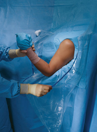 O&M Halyard Inc Orthopedic Drape Shoulder Arthroscopy Drape 160 W X 102 L Inch Sterile - Case of 10 - 89070-CS