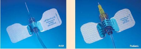 BD IV Extension Set StatLock™ IV Select Micro Bore 6 Inch Tubing Without Filter Sterile - Box of 25 - IV0572-BX