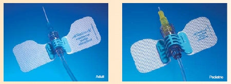 BD IV Extension Set StatLock™ Needle-Free Port Micro Bore 6 Inch Tubing Without Filter Sterile - Box of 25 - IV0565-BX