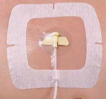 Medline Port Window Dressing SecureView Film 5-1/2 X 6-1/2 Inch Sterile - Case of 50 - SCP66VXT-CS