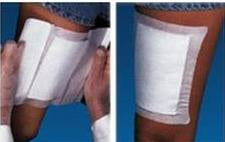 Stradis Medical Professional Adhesive Dressing 6 X 6 Inch Gauze Square White Sterile - Case of 30 - 816-656N-CS