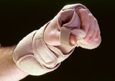 Alimed Wrist / Hand / Thumb Splint Orthosis AliMed® Omni Progressive™ Low Profile Aluminum / Foam / Terry Cloth Left Hand Beige One Size Fits Most - Each - 2970002056-EA