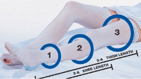 Carolon Company Anti-embolism Stocking Cap® Thigh High X-Large / Short White Inspection Toe - Pair - 640-PR